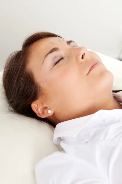 Uroda twarzy leczenie akupunktura — Zdjęcie stockowe