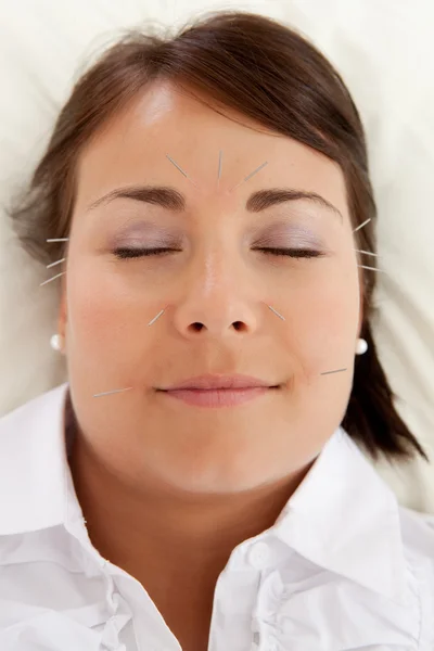 Obličeje krása akupunkturní léčby — Stock fotografie