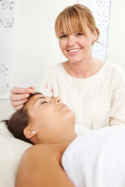 Terapia dell'agopuntura facciale — Foto Stock