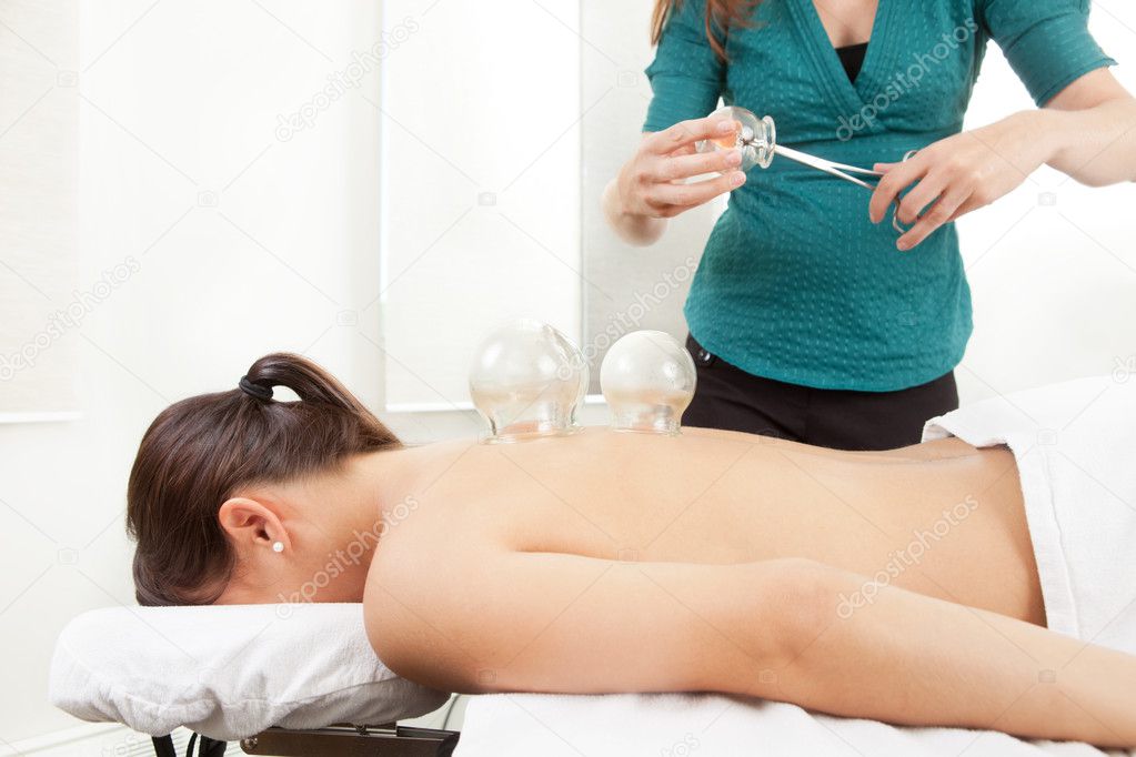 Cupping Acupuncture Treatment