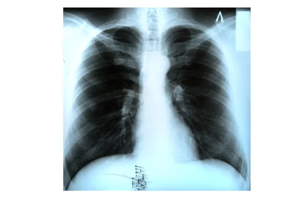 X-ray makro — Zdjęcie stockowe