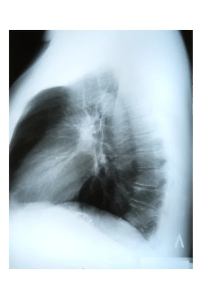 Рентген на белом — стоковое фото
