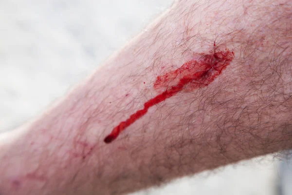 Sangue su una gamba maschile. Lesioni, infortuni — Foto Stock