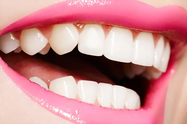 Макро улыбка счастливой женщины со здоровыми белыми зубами, яркие блестящие губы — стоковое фото