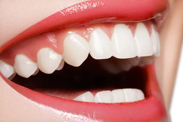 Närbild glad kvinna leende med friska vita tänder, rosa läppglans läppar — Stockfoto