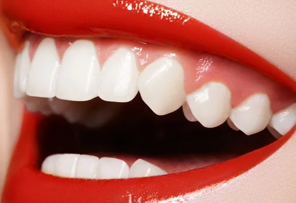 Крупным планом счастливая женская улыбка со здоровыми белыми зубами, красные блестящие губы — стоковое фото