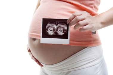 Pregnant with ultrasounds clipart
