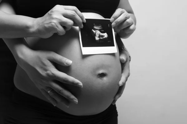 Embarazada con ultrasonidos —  Fotos de Stock