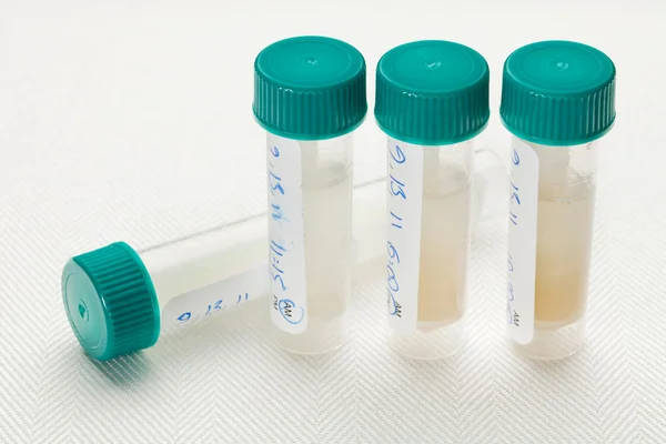 Saliva samples for laboratory test — Stock Photo, Image