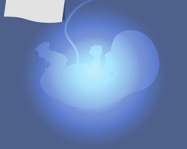 胎儿和 x 射线 — 图库矢量图片