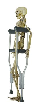 Skeleton on Crutches clipart