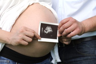 Pregnancy: couple holding ultrasonic image of baby clipart