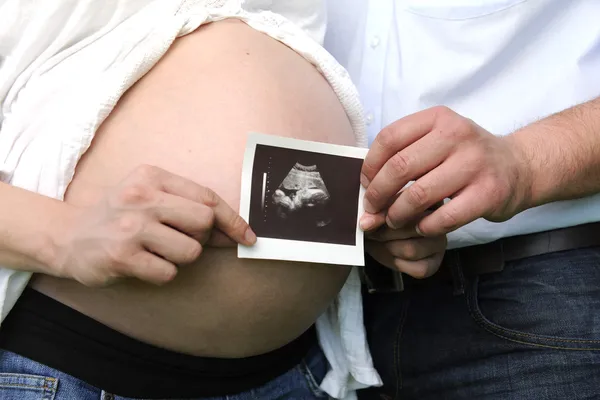 Беременность: пара, держащая ультразвуковой образ ребенка — стоковое фото