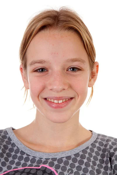 Portret nastolatka z pimpels — Zdjęcie stockowe