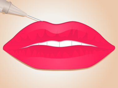 Lip filler injection clipart