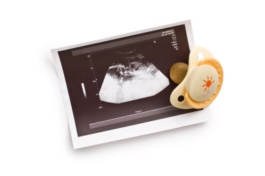 Ultrasound photo with pacifier clipart