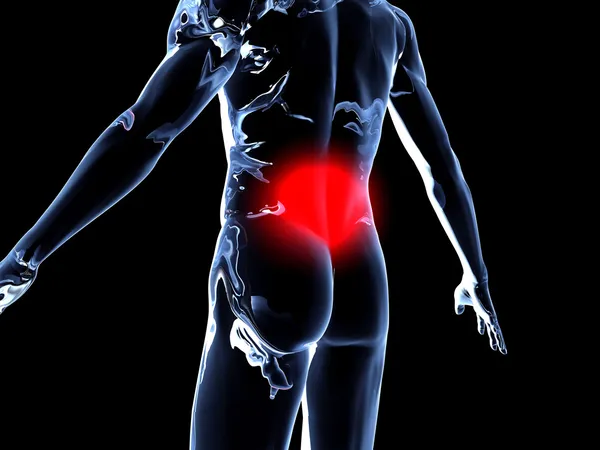 Sırt ağrısı - anatomi — Stok fotoğraf