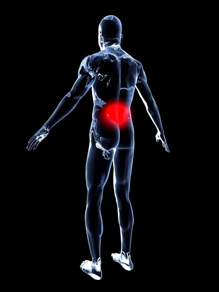 Sırt ağrısı - anatomi — Stok fotoğraf