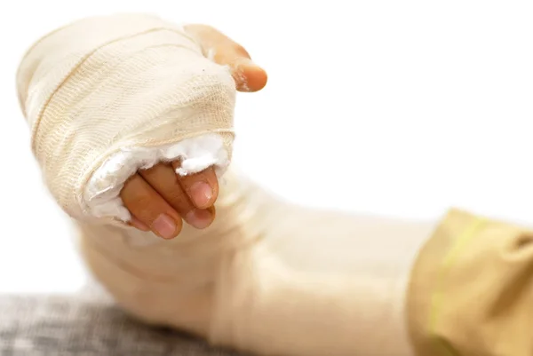 Сломанная рука — стоковое фото