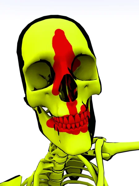 Cartoon skelet met bloed — Stockfoto