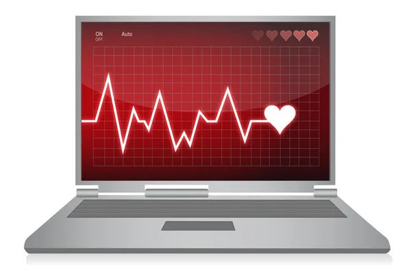 Battiti cardiaci - disegno illustrazione monitor elettrocardiogramma — Foto Stock