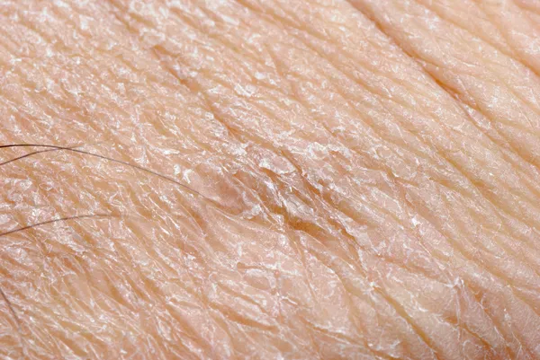 Suchá kůže textura — Stock fotografie