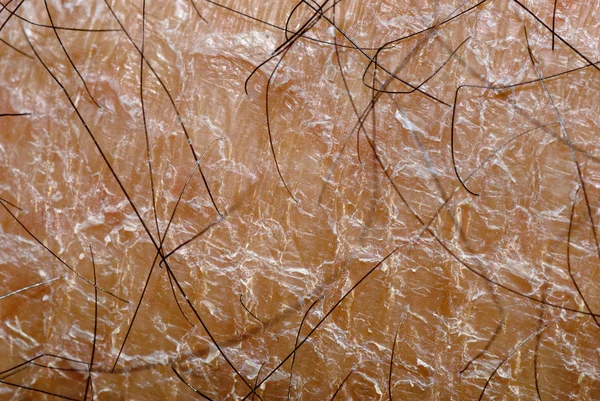 Textura seca da pele — Fotografia de Stock