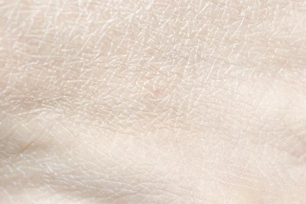 Pele humana seca — Fotografia de Stock
