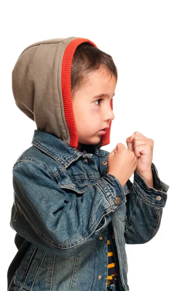 Profiel portret van kleine jongen met zwart oog in de strijd tegen stanc — Stockfoto