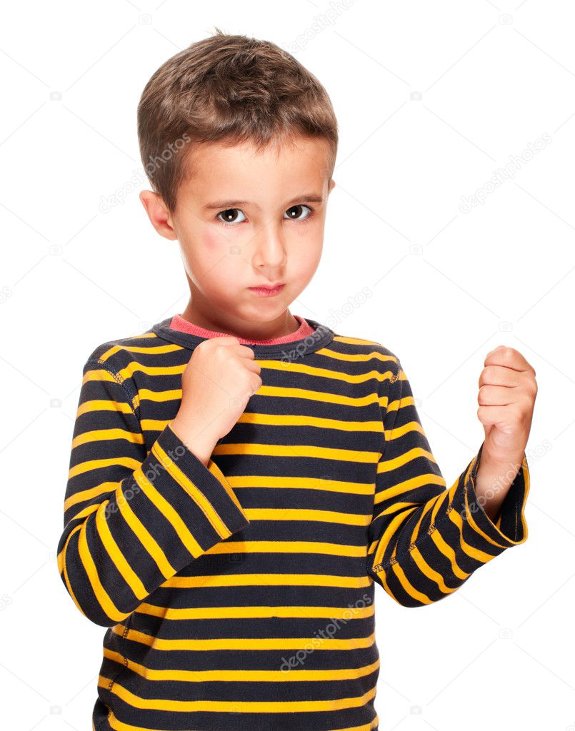 Little bully boy with black eye in fighting stance