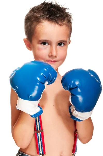 Маленький хулиган с синяком под глазом в боксёрских перчатках — стоковое фото