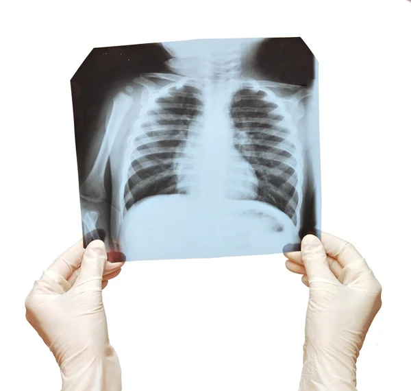 Doctor examining the X-ray over white — Stock Photo, Image