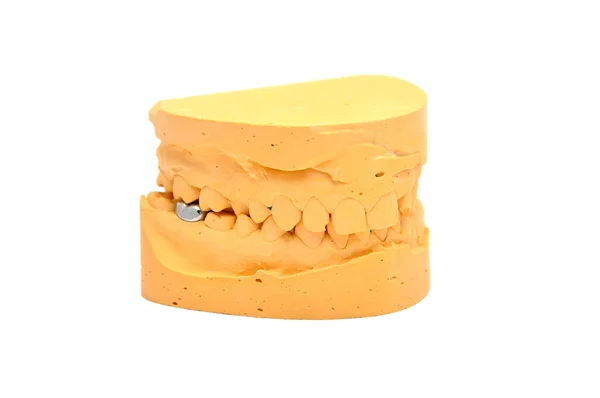 Formy dentystyczne — Zdjęcie stockowe
