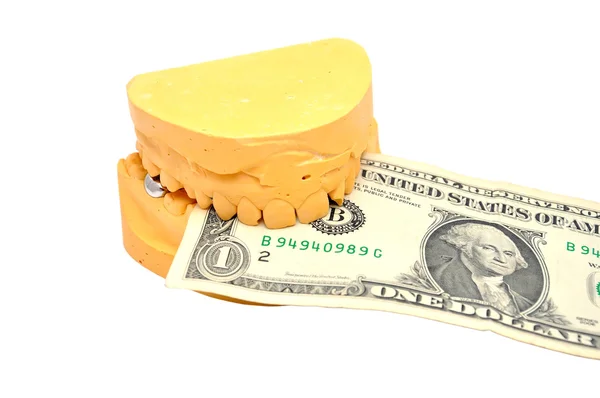Moule dentaire et dollar — Photo