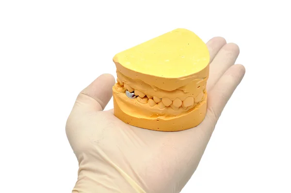 Dental mould and hand — Stock Photo, Image