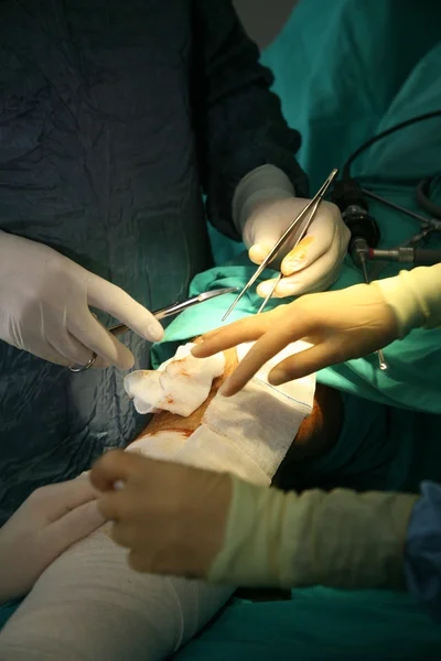 Operacja chirurgiczna — Zdjęcie stockowe