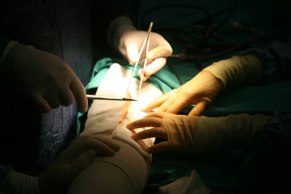 Chirurgische Operation — Stockfoto
