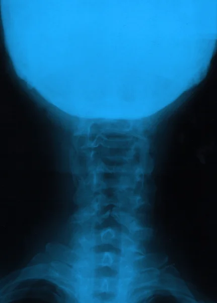人体颈部 — 图库照片