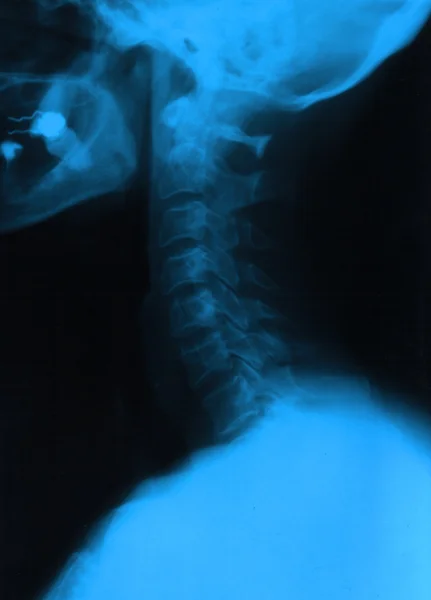 Menschlicher Hals — Stockfoto