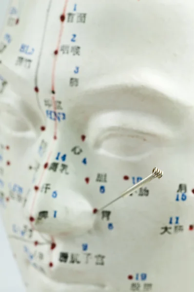 Acupuncture needles on head model — Stock Photo, Image