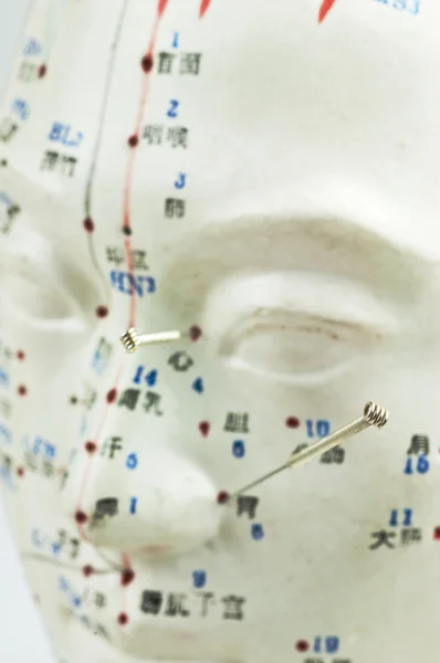 Akupunkturnadeln am Kopfmodell — Stockfoto
