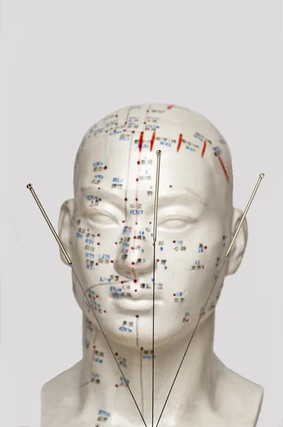 Agulhas de acupuntura no modelo de cabeça — Fotografia de Stock
