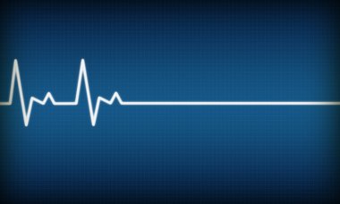 Illustration of EKG trace on blue background