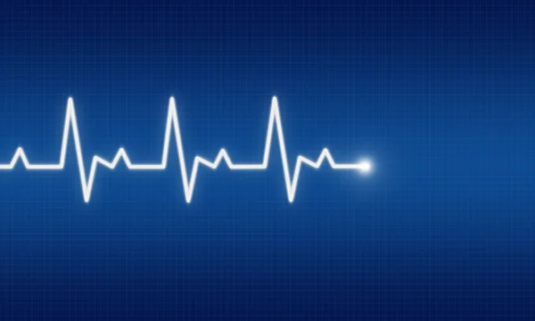 Ilustração de traço de EKG em fundo azul — Fotografia de Stock