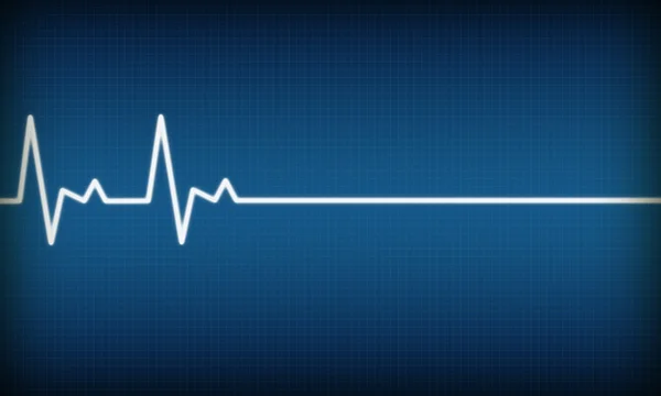 Illustration of EKG trace on blue background — Stock Photo, Image