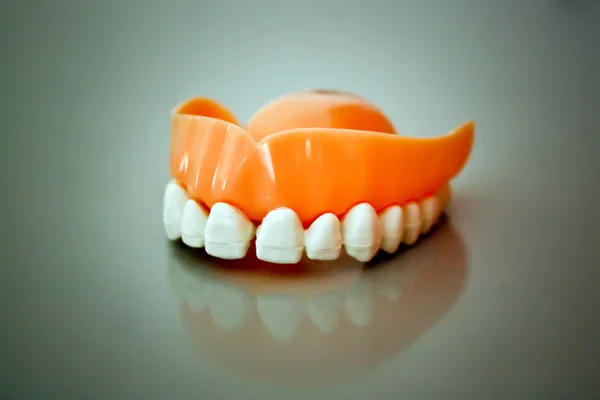 Керамическая модель зубного протеза — стоковое фото
