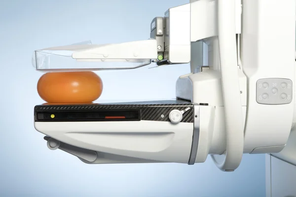 Mamografi makinesi — Stok fotoğraf