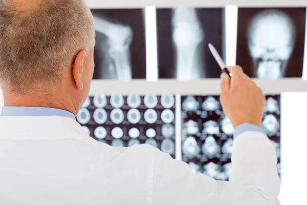 Зрілий лікар чоловічої точки в наборі рентгенівських променів — стокове фото