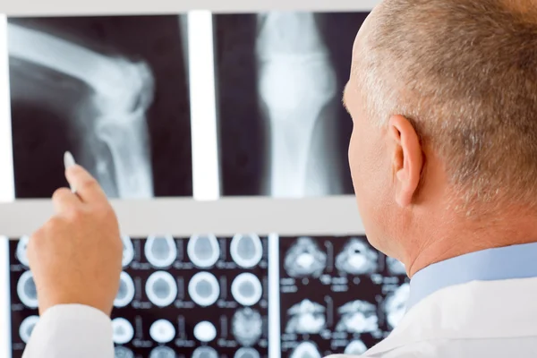 Volwassen arts mannelijke punt in instellen x-ray — Stockfoto