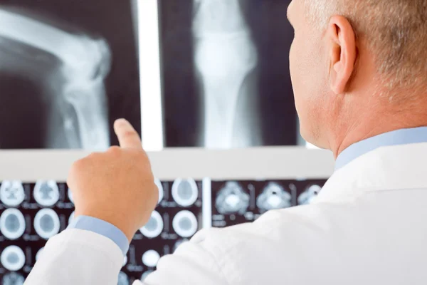 Męski punkt dojrzałych lekarza w zestaw rentgenowski — Zdjęcie stockowe